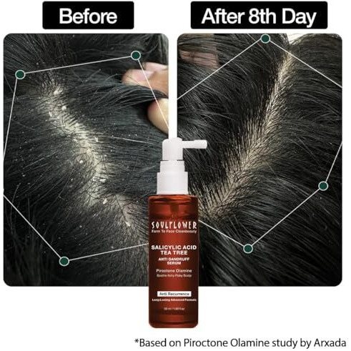 Soulflower Anti Dandruff Hair Serum With Piroctone Olamine, 2% Salicylic Acid & Rosemary Essential Oil For Hair Growth, Anti Hair Fall, Frizz Control Lotion For Men & Women For All Hair Types | 50Ml