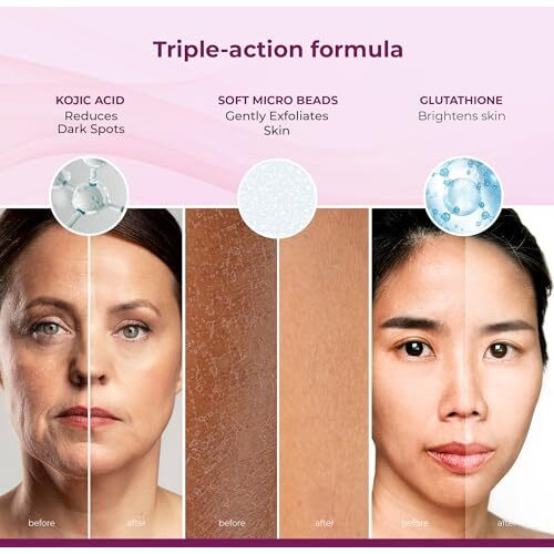 Kozicare Skin Whitening Scrub For Face | Exfoliating Scrub | Scrub For Men & Women Tan Removal Scrub Tanning Dead Skin Removal Gel Kojic Acid Scrub For Blackheads, Whiteheads & Smooth Skin - 100 Gm