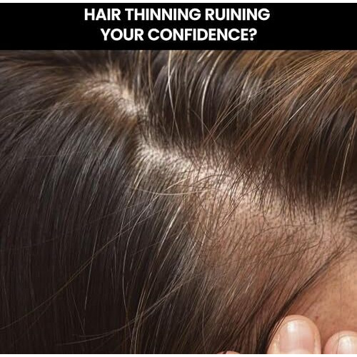Thriveco Hair Thickener Volumizing Serum | For Fine, Thinning Hair | Gives Instant Hair Volume & Density | With Pea Peptide & Rosemary | For Men & Women | Vegan, Cruelty-Free & Dermat-Tested | 100Ml