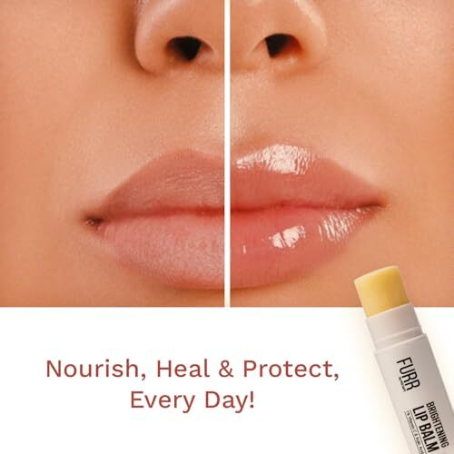 Furr 1% Vitamin C & Kojic Acid Brightening Lip Balm With Spf 30 | Heals, Hydrates & Softens | Reduces Pigmentation | Almond Oil, Shea Butter, Vitamin E Infused | Lip Balm For Soft Glossy Lips | Unisex