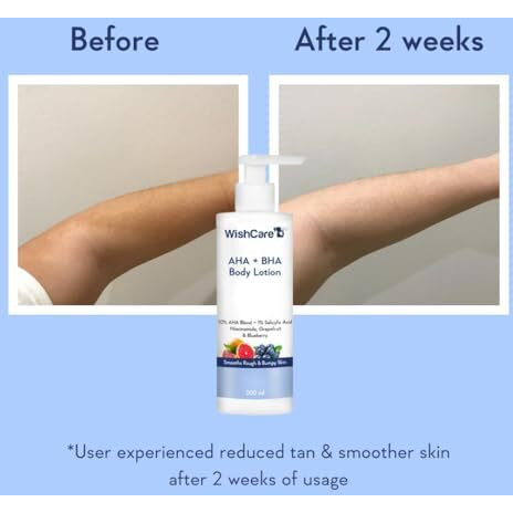 Wishcare 10% Aha + 1% Bha Body Lotion For Men & Women - Body Lotion For Dry Skin - Detans, Smooths Rough & Bumpy Skin 200Ml