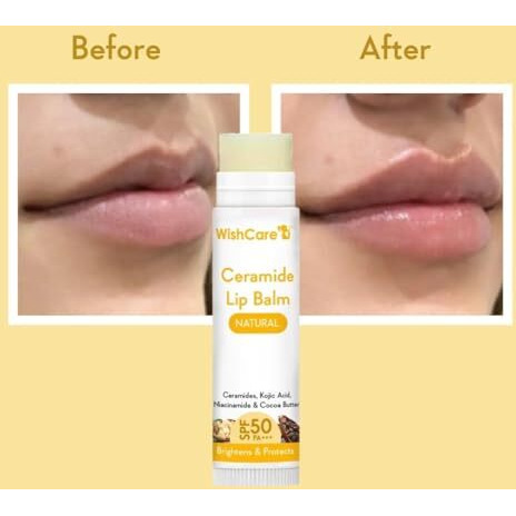 Wishcare Lip Balm With Spf 50 Pa+++ - Brightening Lip Balm For Dark Lips With Kojic Acid & Niacinamide - Spf Lip Balm For Women & Men 5G