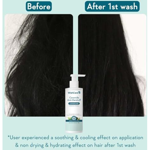 Wishcare Ceramide Anti Dandruff Conditioner For Dry & Frizzy Hair - Piroctone Olamine, Pre+Probiotics & Hyaluronic Acid 200Ml