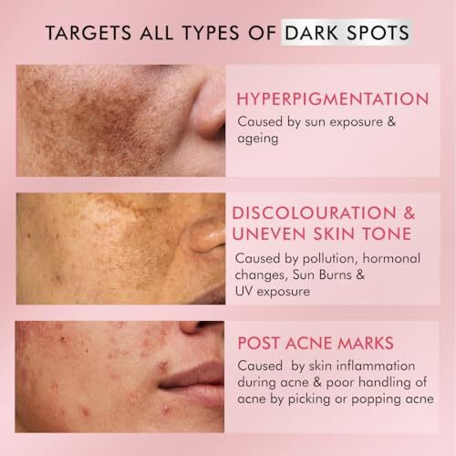 Mcaffeine Clear Glow 1% Kojic Acid Daily Brightening Face Wash With Glutathione For Dark Spots & Pigmentation |Brightens Skin |Face Wash For Men & Women | Non-Drying, Fragrance Free - 100Ml