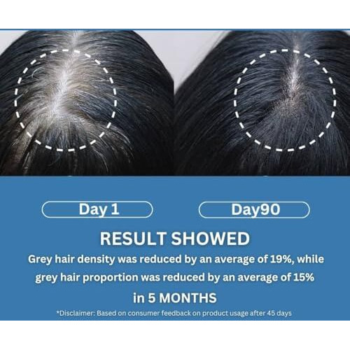 Blushlin Anti Grey Hair Serum With 2% Darkenyl | Anti-Greying Actives With Biotin, Bhringraj, Henna & Amino Acid Complex | Strengthens Roots & Adds Shine | Toxin Free | All Hair Types- 30Ml