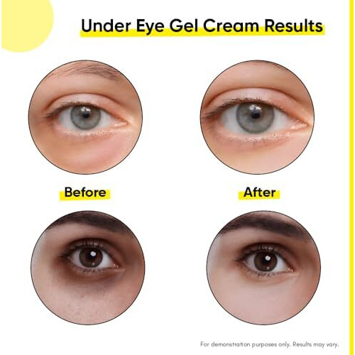 Masofta Under Eye Gel Cream For Dark Circles, Fine Lines, And Puffy Eyes, With Retinol, Niacinamide, Caffeine, Vitamin C, & Aloe Vera Extract For Both Men & Women, 30Ml