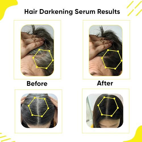 Masofta Anti Grey Hair Darkening Serum | Limits Hair & Beard Greying | Promotes Shinier Hair | With Arcolys, Melano Gray, Biotin & Bhringraj For Both Men & Women, 30Ml