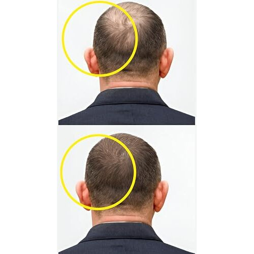 Masofta Hair Growth Serum For Promoting Hair Growth & Controlling Hair Fall | With 3% Redensyl, 5% Capixyl, 4% Anagain, 3% Procapil & 3% Baicapil, Rosemary & Biotin, For Both Men & Women, 30Ml