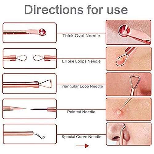 Macplus 4Pcs Blackhead Pimple Golden Remover Tools For Professional Tweezers Kit For Remove Acne Comedone Extractor, Black Heads Removing On Face Removal