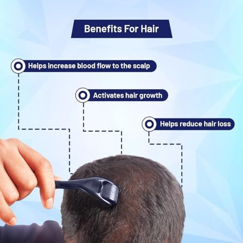 Formen Derma Roller For Hair Growth 0.5 Mm With 540 Titanium Needles | Repairs Damaged Hair, Activates Hair Follicles | For Hair Fall & Hair Thickening | Reduces Acne Scars | Safe & Effective To Use