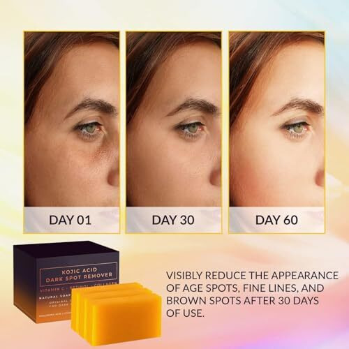 Kojic Acid Dark Spot Remover Soap Bars With Vitamin C, Retinol, Collagen, Turmeric - Original Japanese Complex Infused With Hyaluronic Acid, Vitamin E, Shea Butter (Pack Of2 Pcs)