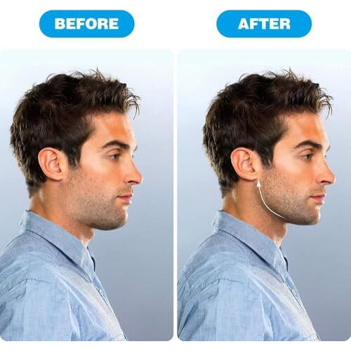 Pack Of 2 Jawline Exerciser - Premium Jawline Exerciser Tool For Men - Highly Effective Jaw Line Shaper For Strengthening & Toning Facial Muscles