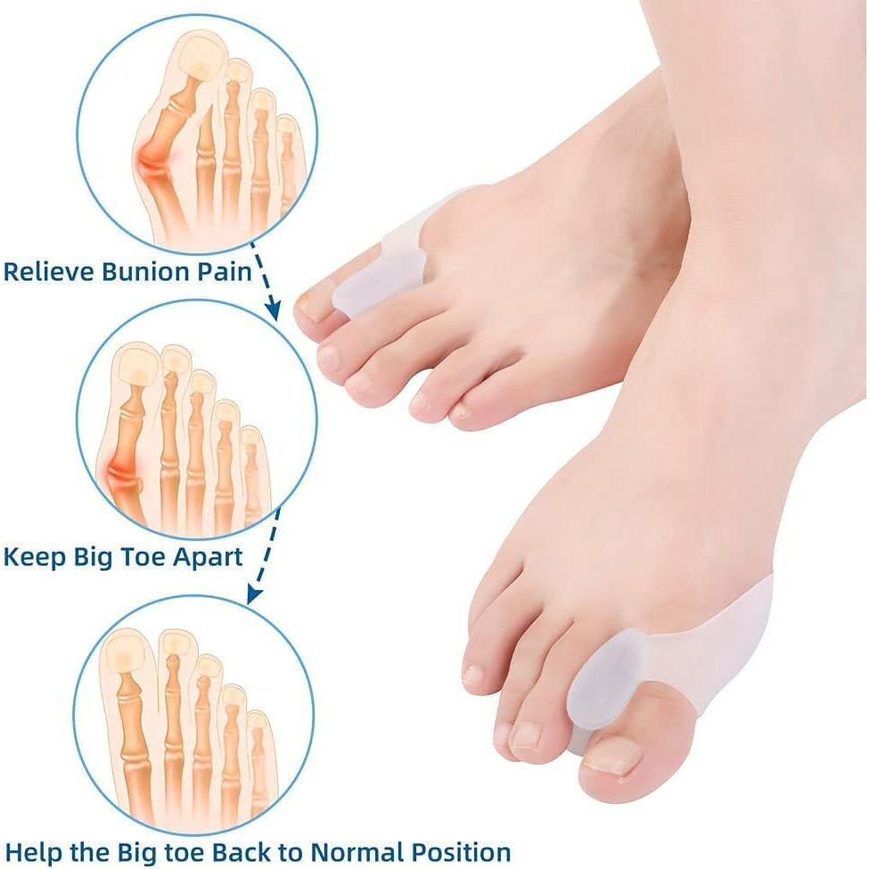 Suefor Gel Big Toe Bunion Guards & Toe Spreaders Bunion Pads- Big Toe Separator Cushion Straightener - Gel Toe Spacers, Protectors, Correctors - Non Toxic (Max)