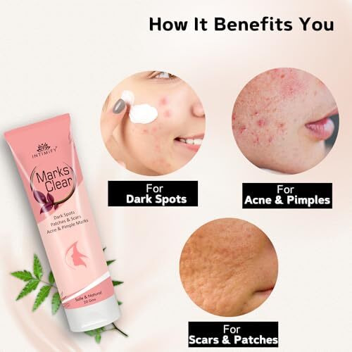 Intimify Dark Spot, Scar Cream For Face, Acne Scars Cream For Women & Men (20 Gm)