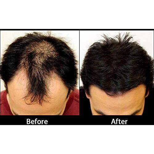 Rebuilds Hair Building Fibers, Dark Brown, 27 Grams