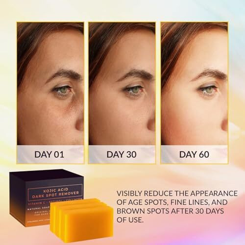 Durvuddi Kojic Acid Dark Spot Remover Soap Bars With Vitamin C, Retinol, Collagen, Turmeric - Original Japanese Complex Infused With Hyaluronic Acid, Vitamin E, Shea Butter, [Pack Of 2]