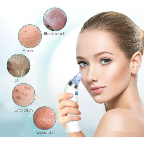 Halifoxt 4 In 1 Multi-Function Blackhead Whitehead Extractor Remover Device, Skin Cleaner, Pimple Removal Tool, Acne Pimple Pore Cleaner Vacuum Suction Tool For Men And Women (White)