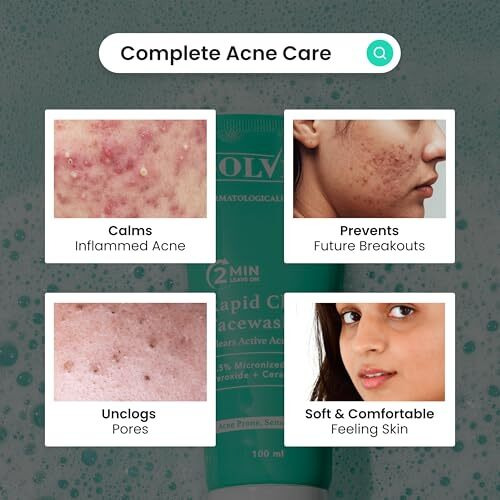 The Solved Skin India's 1St Dermatologically Tested Acnewash With Patented Micronized Benzoyl Peroxide. Kills 99% Acne Causing Bacteria, & Calms Inflamed Pimples In 4 Days. Normal To Oily Skin. 100Ml