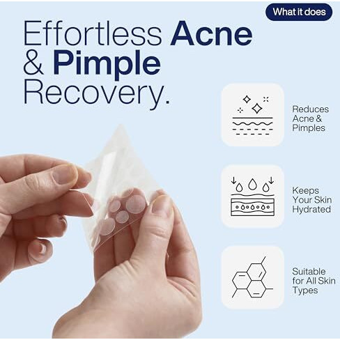 Total Routine Acne Recovery Patch | Pack Of 72 Hydrocolloid Waterproof Pimple Patches | For Active Surface Acne | Reduces Acne, Pimples & Excess Oil Overnight | Invisible, Blemish Spot