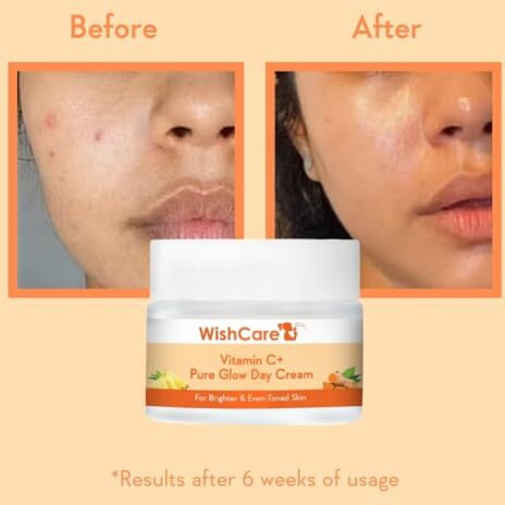 Wishcare Pure Glow Vitamin C Face Cream For Women & Men - Day & Night Cream - For Glowing, Bright, Young And Pigmentation Removal - With Hyaluronic Acid, Niacinamide, Oranges, Berries & Turmeric-50 Gm (Pgfc50)