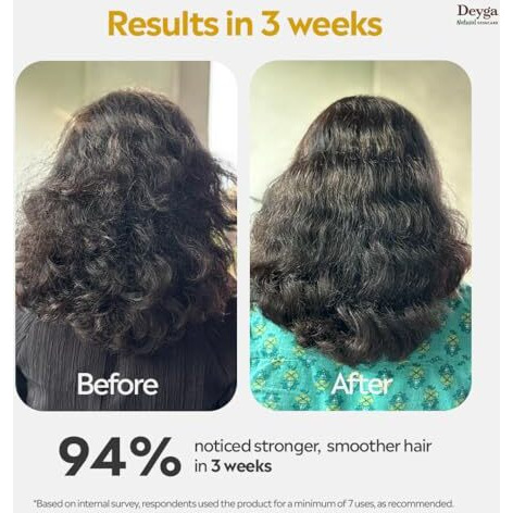 Deyga Rice Water Shampoo (220 Ml) | Controls Frizz | Deep Cleanses Scalp | Free From Paraben And Sulfate