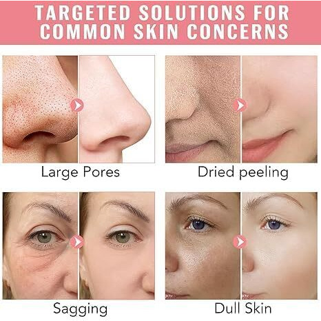 Shayonam Pack Of 1 Collagen Overnight Face Mask | Korean Glass Skin Hydrogel Mask For Deep Hydration, Pigmentation, Anti-Aging & Pore Minimizing | Hyaluronic Acid, Niacinamide, Vitamin E & Centella