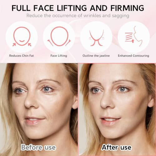 Maycreate V Line Face Lifting Mask, Double Chin Reducer Jaw Line Shaper, Face Toning Belts, Lifting And Firming Compression Strap For Sleeping Anti-Wrinkle Skin Tightening Belt For Slim Lift