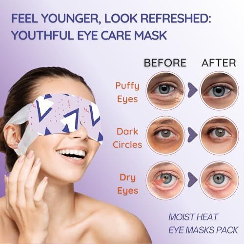 Unwynnd Steam Eye Mask, Eye Mask For Dark Circles & Dry Eyes Relief, Travel-Friendly Self Warming Sleep Mask, Enjoy Relaxing Spa Eye Care, Pack Of 5 (Lavender)