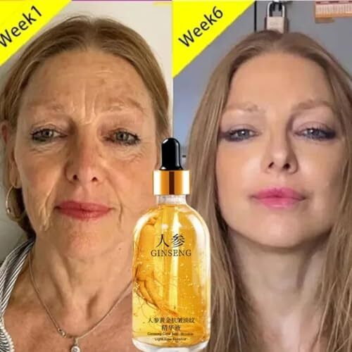 Chitaaksh Gold Ginseng Face Serum Polypeptide Anti-Wrinkle Lightning Moisturizing Niacinamide Facial Serum For Skin Care