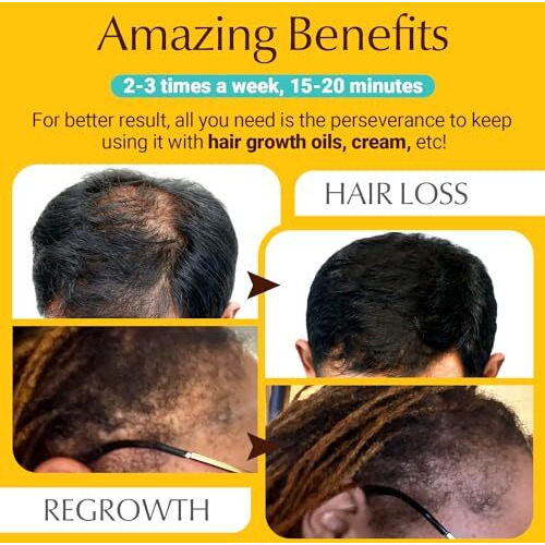 Novusol Laser Hair Growth Comb, Professional Medical Grade Lasers, Electric Scalp Massager For Hair Growth, Stimulates Hair Growth Comb Brush Thinning Hair Treatment Laser Therapy Comb, Treat Alopecia