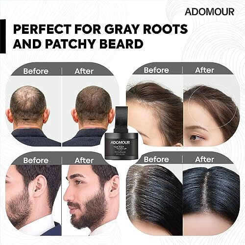 Adomour Root Touchup Powder 4G - Instant Coverage For Hair Loss, Bald Patch & Grey Hair | Sweat & Stain Resistant 24Hr Formula | Hairline Powder For Men & Women (Black)