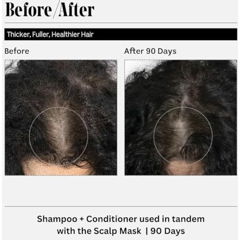 Ravel Hairfall Control Shampoo, Reduces Hair Fall & Strengthens Roots, Promotes Hair Growth & Adds Volume, For All Hair Types, Men & Women - 200Ml