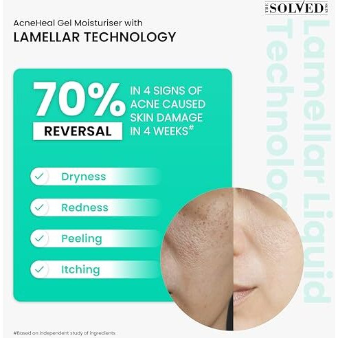 The Solved Skin IndiaS 1St Derma Tested Barrier Repair Gel Moisturiser With Lamellar Liquid Technology Reverses 4 Signs Of Skin Damage By 70% Within 4 Weeks. 48 Hours Hydration. 50Ml