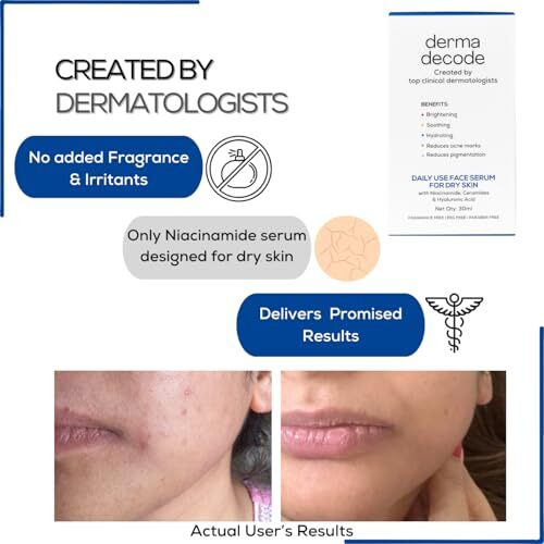 Derma Decode Niacinamide 10% + Hyaluronic Acid, Intense Hydration Face Serum For Dry Skin - Clear Glowing Skin With Skin Repair, Pore Minimizing | Ceramides & Vit B3 Serum | Sensitive Skin Safe, Dermatologist Tested - 30Ml