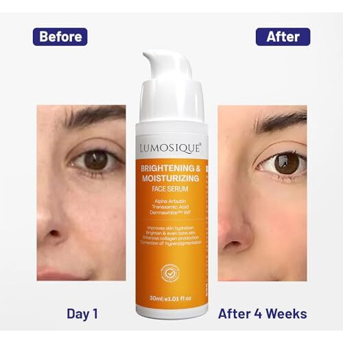 Lumosique Brightening And Moisturizing Face Serum For Hydrates, Brightens & Evens Tone Skin, Boosts Collagen & Corrects Hyperpigmentation | Oily, Dry, Sensitive & Combination Skin | Men & Women, 30Ml