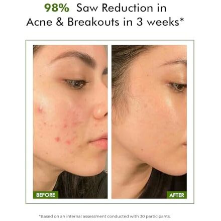 Conscious Chemist 2% Salicylic Acid Serum | 30Ml | Face Serum For Acne, Blackheads & Opne Pores, Reduce Excess Oil & Bumpy Texture, Bha Based Exfoliant For Acne, Face Serum For Men & Women - Flashfix