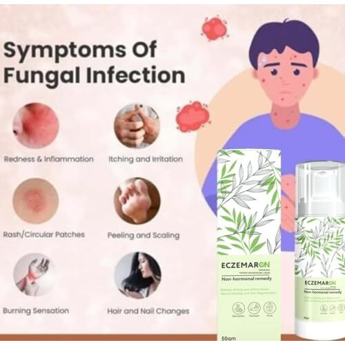 Eczemaron Ringworm Wart, Massa And Skin Tags Removal Herbal And Itchcoat Anti Fungal Ayurvedic Medicine- 50Gm
