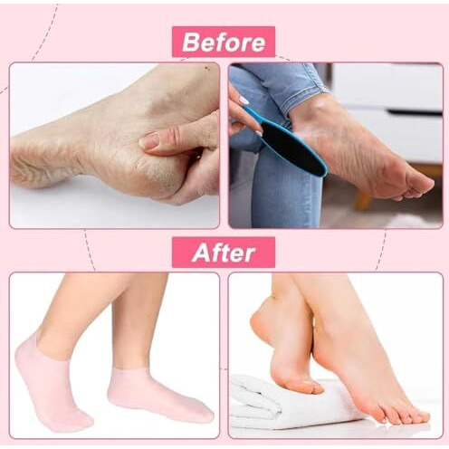 Proxism Silicone Socks For Women, Moisturizing Foot Socks, Soft Gel Socks, Aloe Socks, Women Spa Pedicure Socks (2-Pair) Multicolor (Pack Of 2)