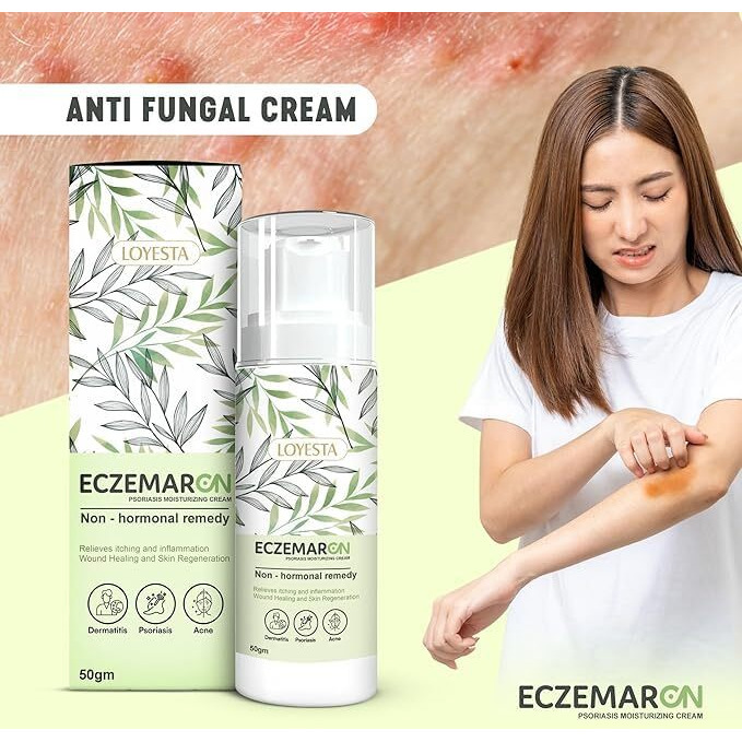 Eczemaron Fungal Cream For Men & Women Ayurvedic Itchcoat Anti Fungal Malam For Ringworm Itching Eczema Cream 50Gm