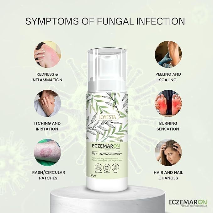 Eczemaron Fungal Cream For Men & Women Ayurvedic Itchcoat Anti Fungal Malam For Ringworm Itching Eczema Cream 50Gm