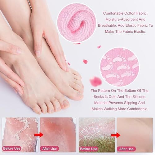 Silicone Spa Gel Moisturizing Socks For Women And Men For Dry Crack Feet Heel Repair Gel Socks Natural Oil And Vitamin E (Multicolor) (1 Pair)