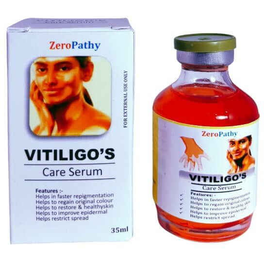 Vitiligo Cream To Care Ringworm White Spots, Tag Skin,Herbal Vitiligo Repair Gel With Organic Aloe Vera And Neem, Helps Fade Patches, Restores Natural Pigmentation Vitiligo Spot For Men & Women. 35Ml