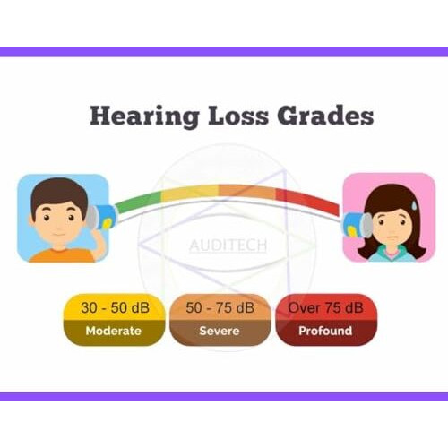 Auditech 'star' Behind-The-Ear (Bte) Hearing Aid - Sound Amplifier For Up To 50% Hearing Loss (Beige)