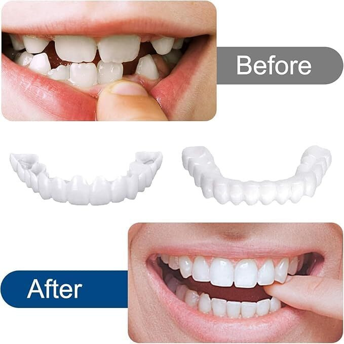 Veroflame Snap-On Instant Perfect Smile Veneers Comfortable Flex Fit Dentures For Top & Bottom| Tooth Cosmetic Cover Comfort Fit Flex Dentures For White Neat Smile