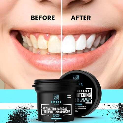Rivona Naturals Activated Charcoal Teeth Whitening Powder - For Enamel Safe Teeth Whitening, Stain Remover, Freshens Breath - With Activated Charcoal & Clove Powder - 70G (Fluoride Free) Pack 2