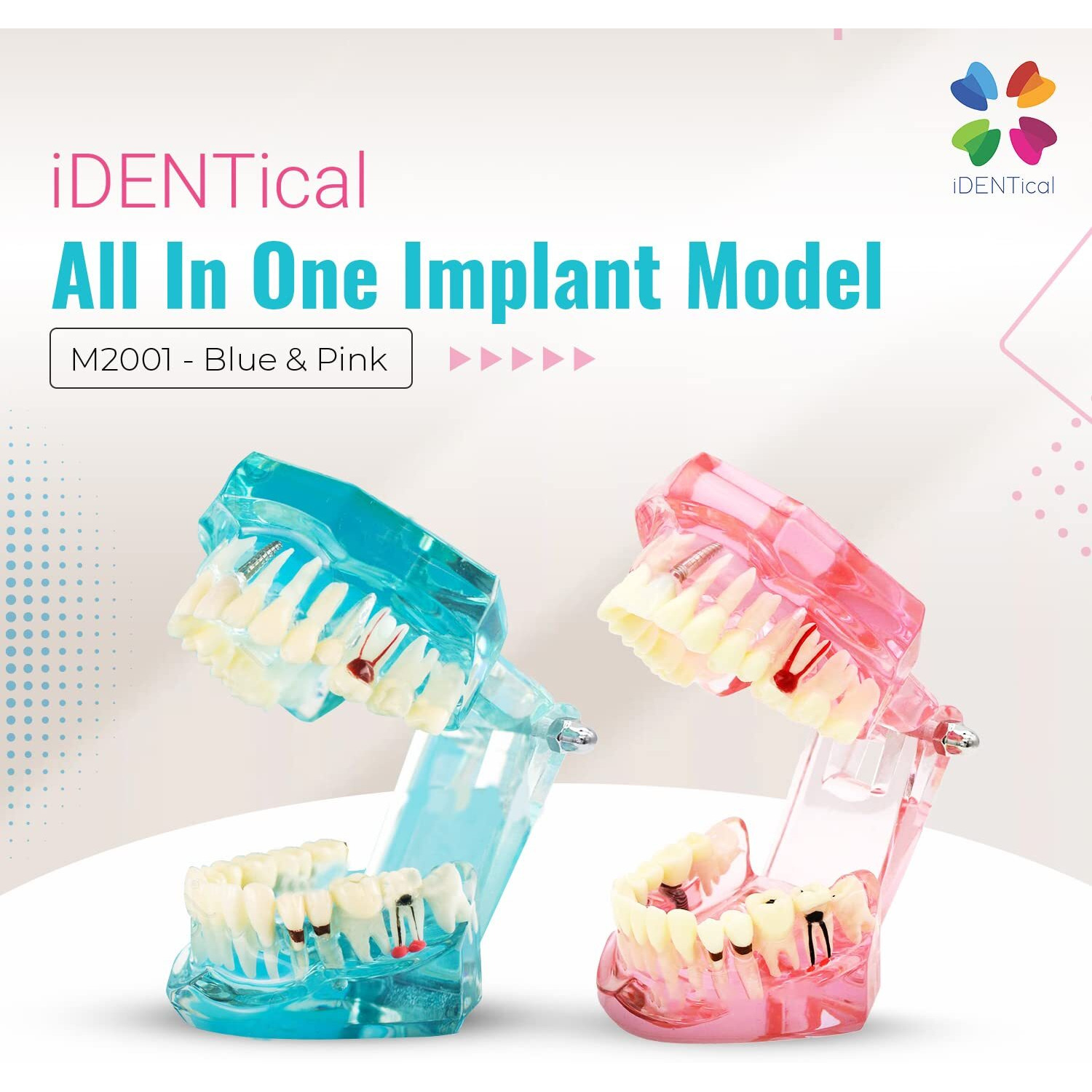 Identical All-In-One Implant & Restoration Model M2001  Blue | Comprehensive Dental Training Model For Implantology, Prosthetics & Restoration | Ideal For Study, Demonstration & Practice