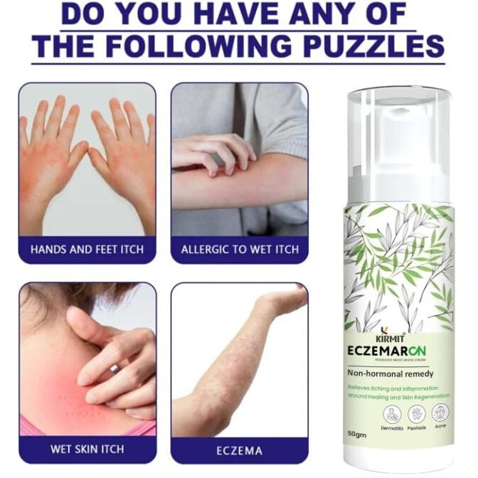 Eczemaron Fungal Cream For Men & Women Ayurvedic Itchcoat Anti Fungal Malam For Ringworm Itching Eczema Cream- 50G (Pack Of 2)