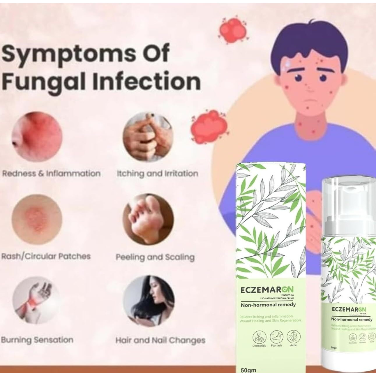 Eczemaron Fungal Cream For Men & Women Ayurvedic Itchcoat Anti Fungal Malam For Ringworm Itching Eczema Cream (Pack Of 2)
