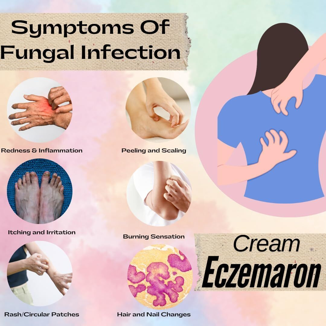 Eczemaron Fungal Cream For Men & Women Ayurvedic Itchcoat Anti Fungal Malam For Ringworm Itching Eczema Cream- 50G ((Pack Of 2))