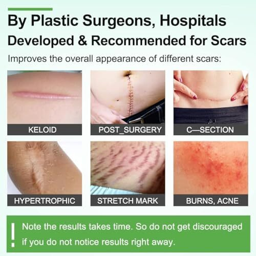 Nexllent Silicone Scar Sheets, Silicon Gel Sheets For Scars Transparent Medical Silicone Gel Tape For Scar Removal, Silicone Scar Tape Roll For Hypertrophic Scars And Keloids Caused By Surgery